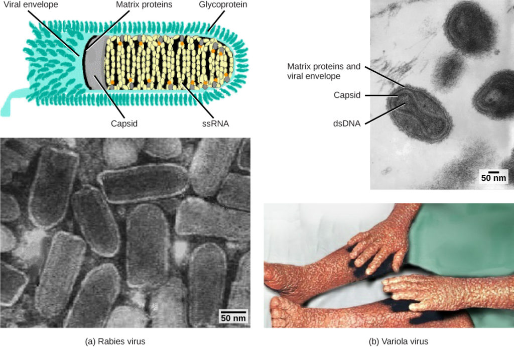 Part a (top) is an illustration of the rabies virus, which is bullet-shaped. RNA is coiled inside a capsid, which is encased in a matrix protein-lined viral envelope studded with glycoproteins. Part a (bottom) is a micrograph of a cluster of bullet-shaped rabies viruses. Part b (top) is a micrograph of variola virus, which has DNA encased in a bow-shaped capsid. An oval matrix protein-lined envelope surrounds the capsid. Part b (bottom) shows irregular, bumpy lesions on the arms and legs of a person with smallpox.