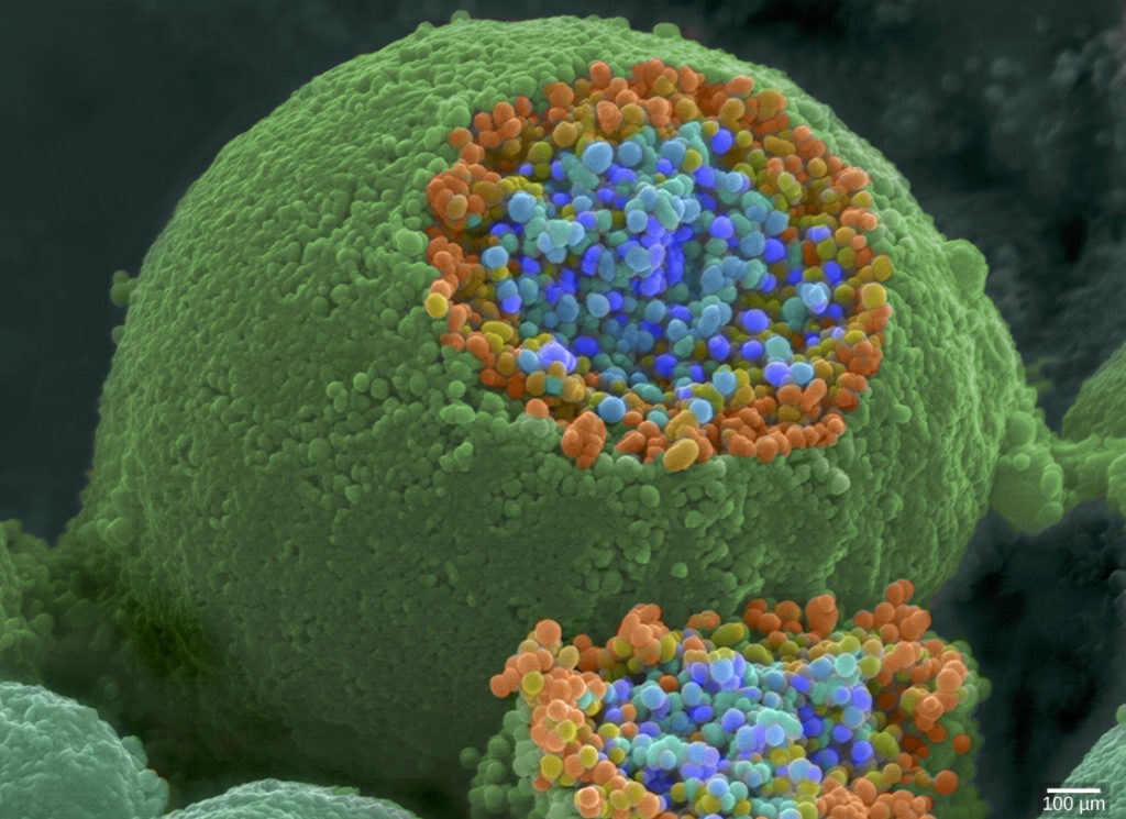 The axon terminal is spherical. A section is sliced off, revealing small blue and orange vesicles just inside.
