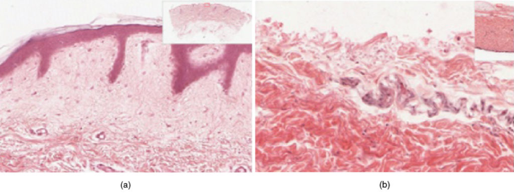 Part A is a micrograph showing a cross section of thin skin. The topmost layer is a thin, translucent layer with irregular texture and areas where cells are sloughing off. The deepest layer is dark purple and extends into the third layer with finger like projections. The third light purple layer contains thin bands of fibers and small, dark cells. The fourth, and deepest layer, is darker than the third layer, but is still light purple. It contains thick fiber bands that are loosely packed. Part B is a magnified view of the epidermis of thick skin. It shows the topmost layer is five times thicker than the topmost layer of thin skin. The topmost layer of thick skin is also denser and less translucent than the topmost layer of thin skin.