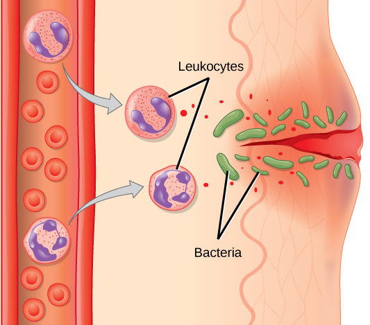 Illustration shows a capillary near the surface of skin that has a cut in it. Bacteria have penetrated the skin around the cut. In response, mass cells in the lower part of the skin tissue release histamines, and dendritic cells release cytokines. The histamines cause the capillary to become permeable. Neutrophils and monocytes exit the capillary into the damaged skin. Both the neutrophil and macrophage release cytokines and consumes bacteria by phagocytosis.