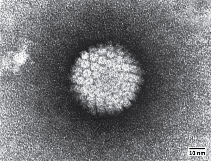 The micrograph shows an icosahedral virus with glycoproteins protruding from its capsid.