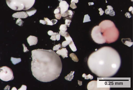 The photo shows small, white shells that look like clamshells, and shell fragments. Each cell is about 0.25 mm across.