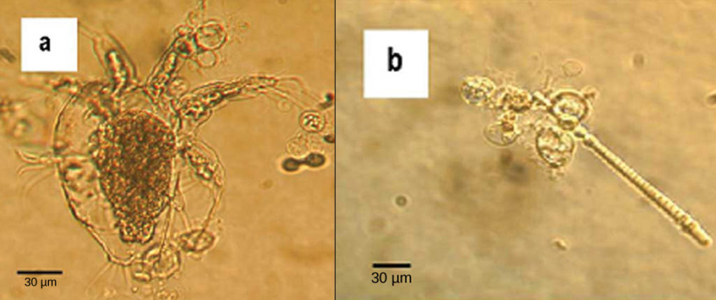 Micrograph A shows an arthropod, which is a teardrop-shaped transparent organism about 90 microns across and 120 microns long. Tentacle-like appendages jut out from the front, wide end of the organism, and clusters of cilia-like appendages just out from either side and the back. Transparent oval organisms about 20 microns across cling to the arthropod. Micrograph B shows a similar oval transparent organisms clinging to rod-shaped algae about 5 microns across and 200 microns long.