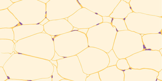 Illustration shows irregularly shaped cells with tiny nuclei clustered next to the cell’s outer membrane.