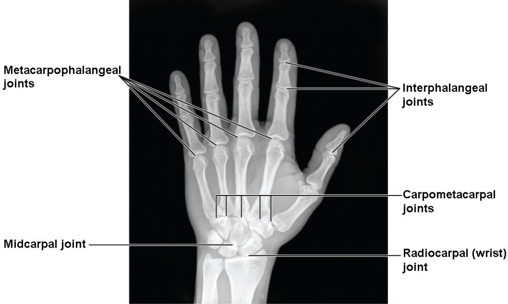 Bones of the Upper Limb | Anatomy and Physiology I