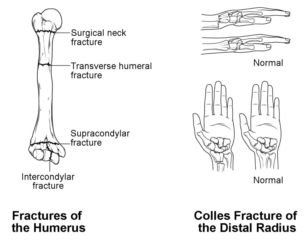 Bones of the Upper Limb | Anatomy and Physiology I