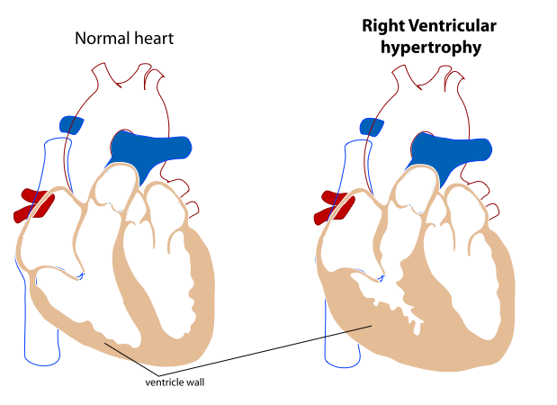 17.1F: Myocardial Thickness and Function - Medicine LibreTexts