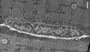 Muscle Development | Boundless Anatomy and Physiology