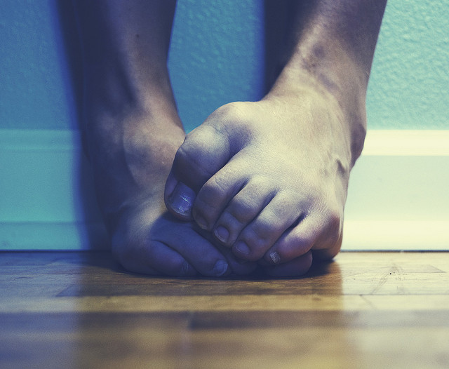 I picture of a person's feet with clenched toes.