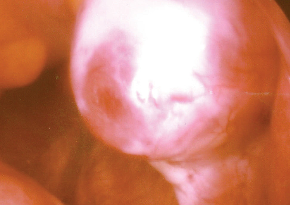 This photo shows an oocyte.