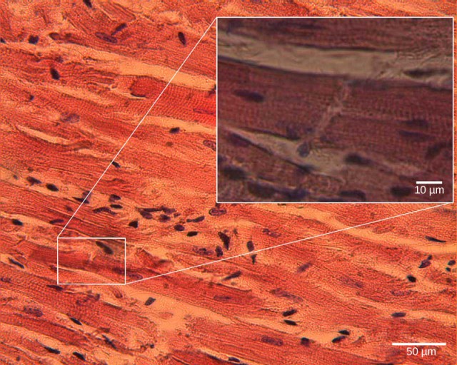 Mammalian Heart and Blood Vessels | OpenStax: Biology