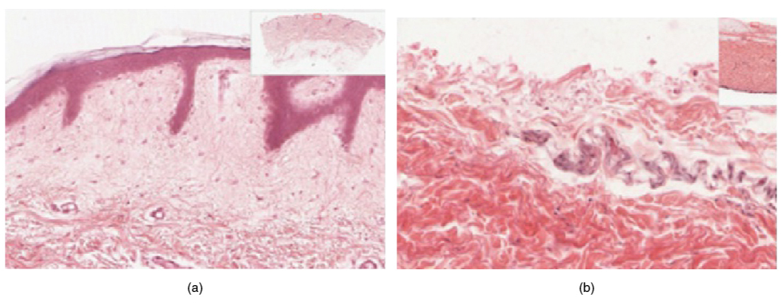 Part A is a micrograph showing a cross section of thin skin. The topmost layer is a thin, translucent layer with irregular texture and areas where cells are sloughing off. The deepest layer is dark purple and extends into the third layer with finger like projections. The third light purple layer contains thin bands of fibers and small, dark cells. The fourth, and deepest layer, is darker than the third layer, but is still light purple. It contains thick fiber bands that are loosely packed. Part B is a magnified view of the epidermis of thick skin. It shows the topmost layer is five times thicker than the topmost layer of thin skin. The topmost layer of thick skin is also denser and less translucent than the topmost layer of thin skin.