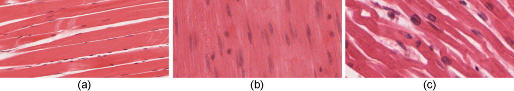 This figure show the micrographs of skeletal muscle, smooth muscle, and cardiac muscle cells.