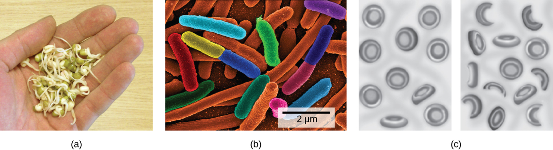 Photo A shows round green seeds with stems sprouting from them. Sketch B shows normal, disk-shaped red blood cells on the left. On the right, many of the red blood cells are sickle-shaped.