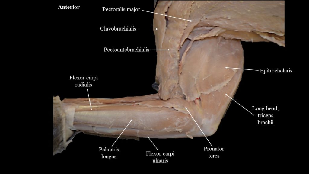 Cat musculature Atlas of Comparative Vertebrate Anatomy