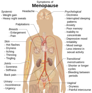 Symptoms of menopause shown on diagram of woman, indicating things like headaches, weight gain, night sneezes, breast pain or enlargement, hot flashes, sore joines, psychological issues, transitional menstruation, etc.