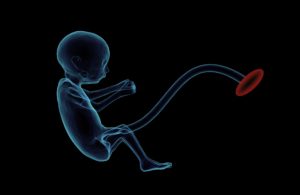 Graphic of a fetus with umbilical cord