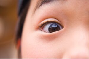 A close-up on a child's eye