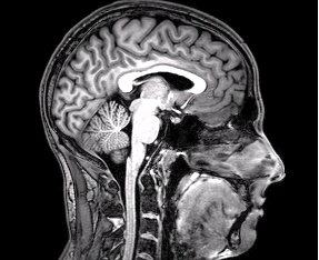 The inside of a human brain