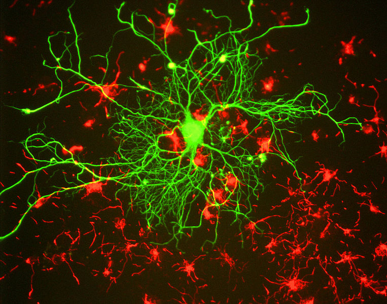 Néuron cortical corado com anticorpos para a subunidade de neurofilamento NF-L a verde. Em vermelho estão as células estaminais neuronais coradas com anticorpos para alfa-interexina. Imagem criada usando anticorpos da EnCor Biotechnology Inc.