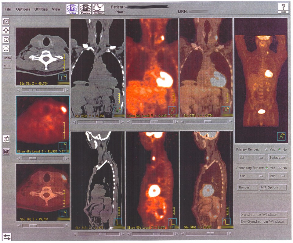 205_Multi-image_Panel_of_PET_Scan-01.jpg