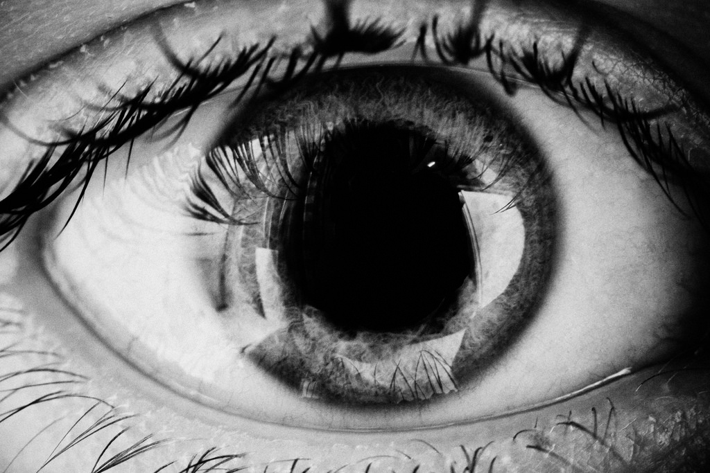 “Eye” by Conal Gallagher is licensed under CC BY 2.0