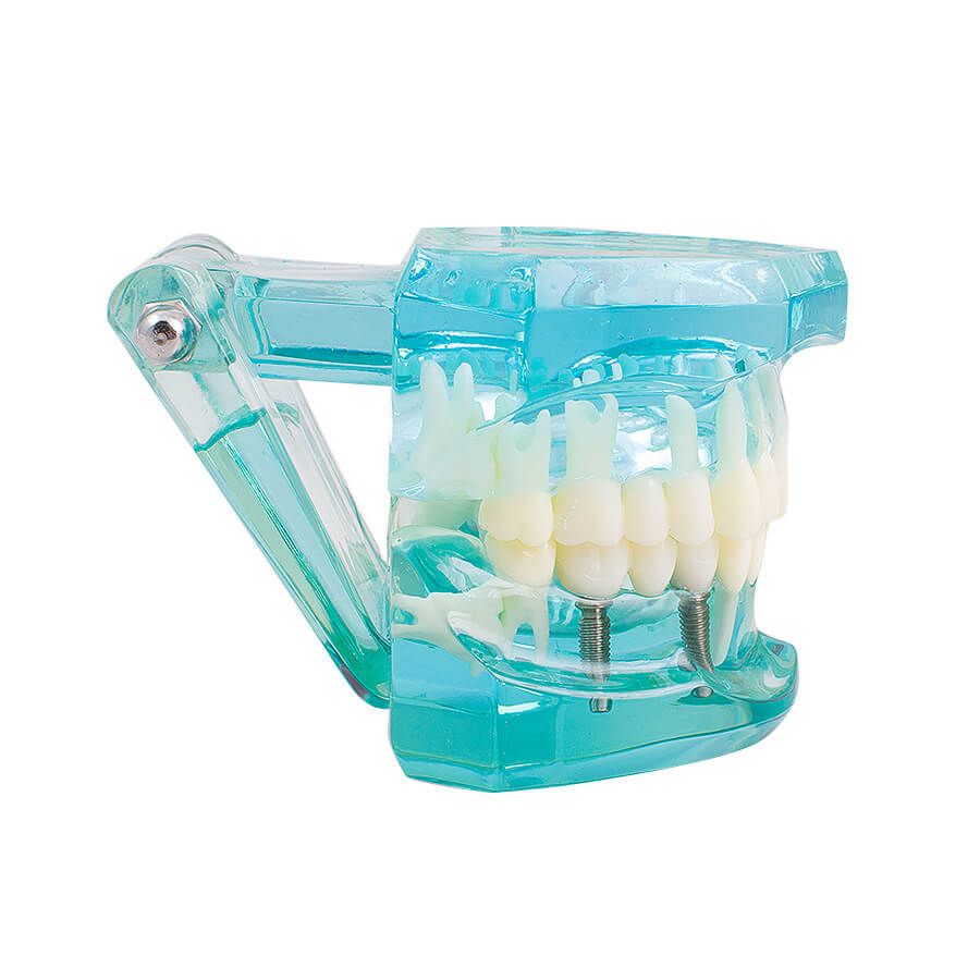 HD Dental USB 2.0 Intra Oral Camera 6 Mega Pixels 6LED Clear Image