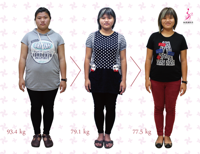 栄養失調 飢餓の結果の1つは栄養失調です。