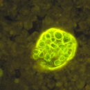 Protein structure of Coccidioides immitis spherule