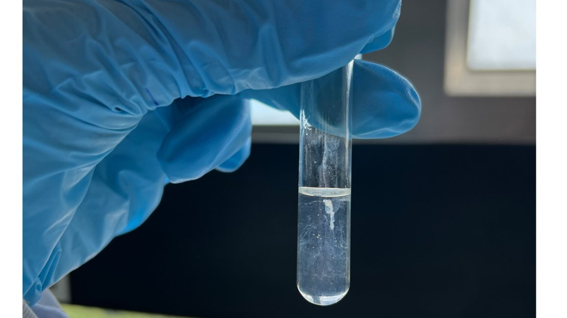 Captured during our Molecular Biology lab while extracting DNA. I was over the moon when I finished the experiment; my DNA extraction turned out to be the most beautiful and successful one in the class!