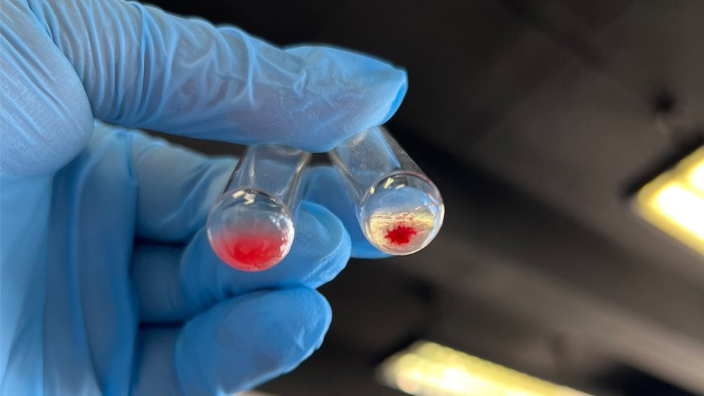 Capturing the moment I processed my first-ever blood sample independently. Such a huge milestone for me! 🧪💪