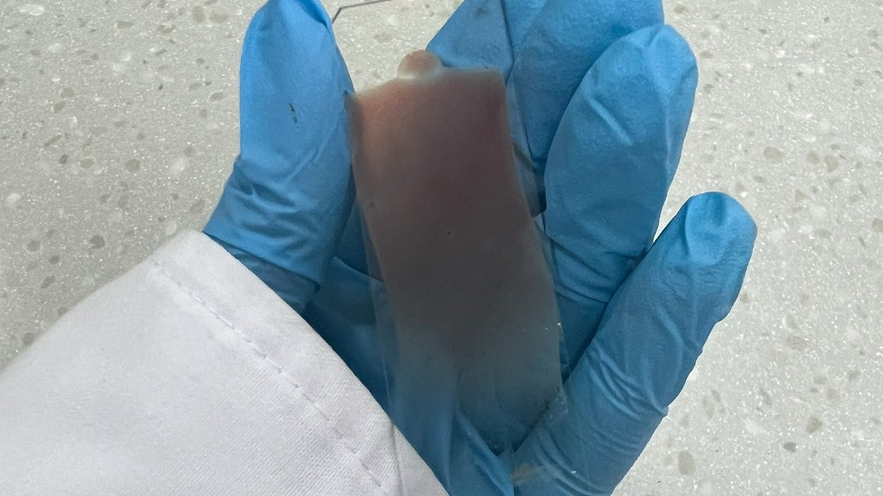 Blood smear