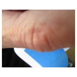 Hoyer Patient Lifter with manual an...