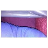 Indoor Outdoor Pillow, Furniture Cover And More.