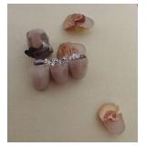 Mixed Gold Tooth Lot