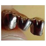 Mixed Gold Tooth Lot