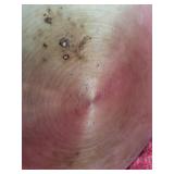 Emeril 8 Quart Stainless Steel Stock Pot with Steamer Insert