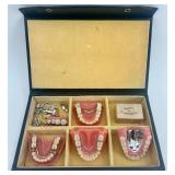 Vintage Dental Prosthetics Display Set in Case