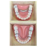 Vintage Dental Prosthetics Display Set in Case