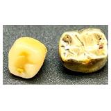 Gold Dental Crown with Natural Tooth Core 3.13g