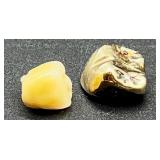 Gold Dental Crown with Natural Tooth Core 3.13g