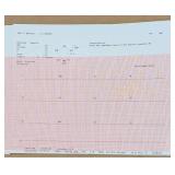GE Marquette MAC 1200 (597223) 12-lead ECG bad battery