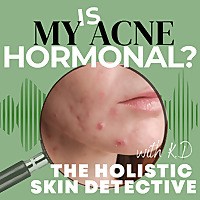 Is My Acne Hormonal?