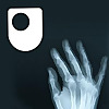 Rheumatoid arthritis - a long term condition - for iPod/iPhone