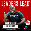 Leaders Lead Even When It Hurts