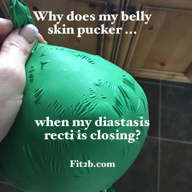 Why does my skin pucker when my diastasis recti is closing? -fit2b.com