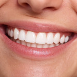 How to whiten teeth naturally (without spending a fortune)