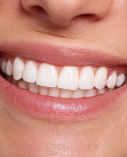 How to whiten teeth naturally (without spending a fortune)