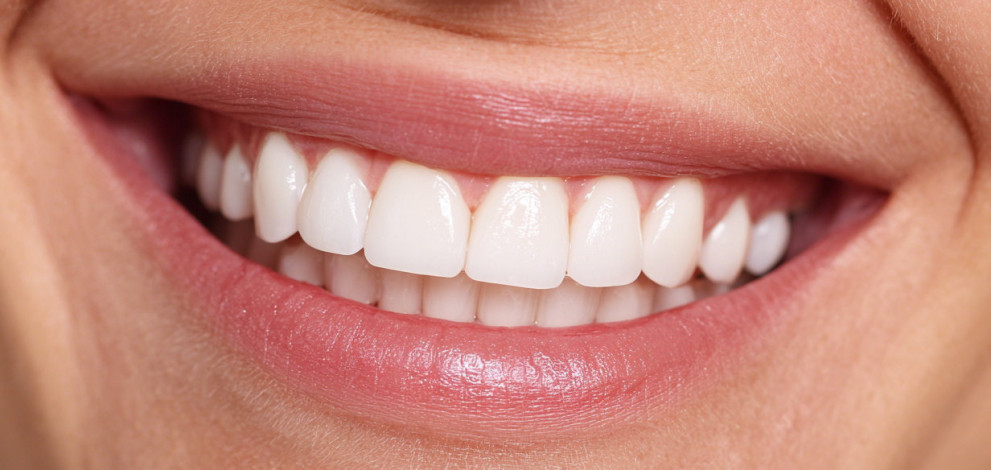 How to whiten teeth naturally (without spending a fortune)