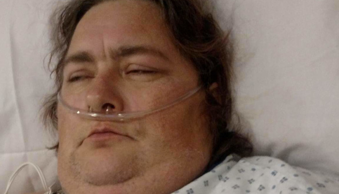 A person resting in a hospital bed wearing a nasal cannula oxygen tube and a hospital gown.